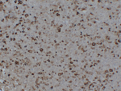 Anti-FSH beta Mouse Monoclonal Antibody
