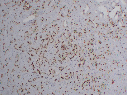 Anti-FLI1 Mouse Monoclonal Antibody