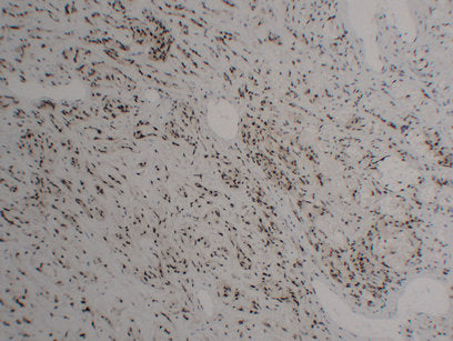Anti-FLI1 Mouse Monoclonal Antibody