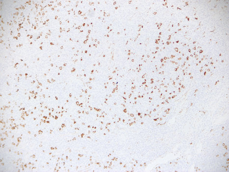 Anti-Fascin Mouse Monoclonal Antibody