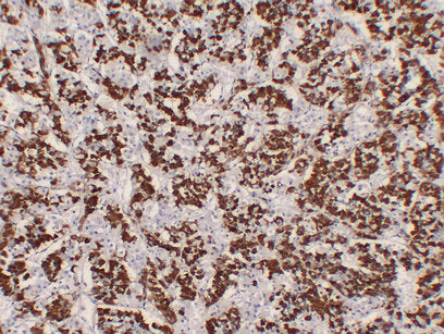 Anti-Growth Hormone Mouse Monoclonal Antibody