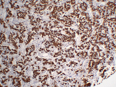 Anti-Growth Hormone Mouse Monoclonal Antibody