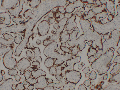 Anti-Glycoprotein Hormones alpha Chain Mouse Monoclonal Antibody