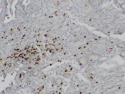 Anti-Gastrin Mouse Monoclonal Antibody