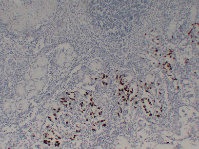 Anti-Gastrin Mouse Monoclonal Antibody