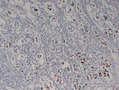 Anti-Gastrin Mouse Monoclonal Antibody