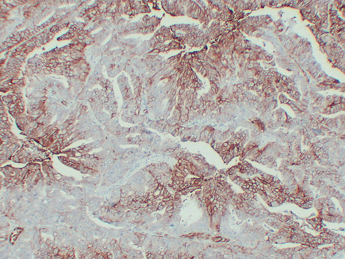 Anti-Glucose Transporter GLUT1 Mouse Monoclonal Antibody