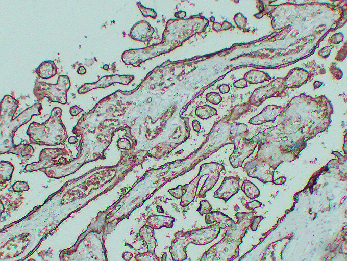 Anti-Glucose Transporter GLUT1 Mouse Monoclonal Antibody