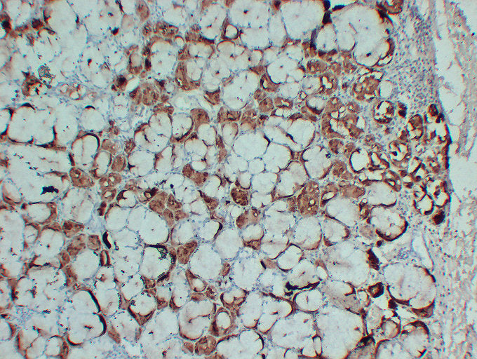 Anti-GCDFP 15 Mouse Monoclonal Antibody