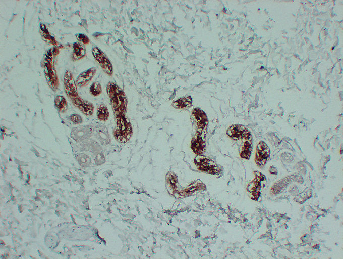 Anti-GCDFP 15 Mouse Monoclonal Antibody