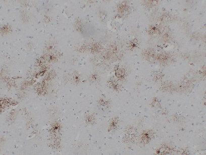 Anti-GFAP Mouse Monoclonal Antibody