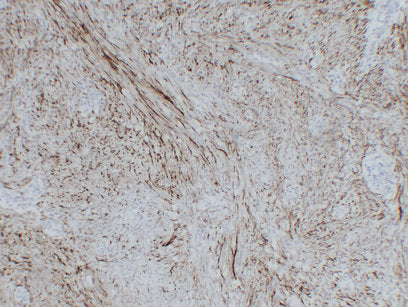 Anti-GFAP Mouse Monoclonal Antibody