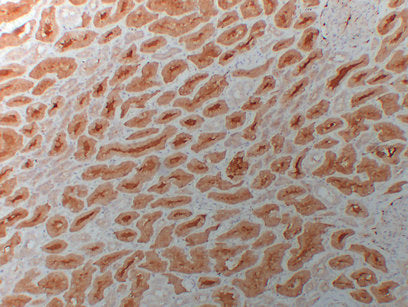 Anti-HDAC6 Mouse Monoclonal Antibody