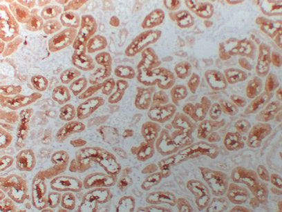 Anti-HDAC6 Mouse Monoclonal Antibody