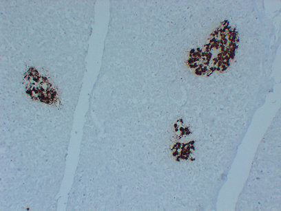 Anti-Insulin Mouse Monoclonal Antibody