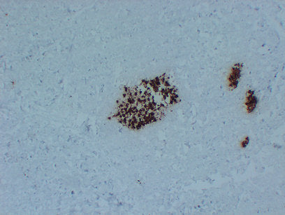 Anti-Insulin Mouse Monoclonal Antibody