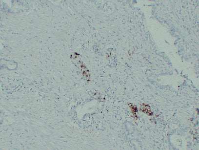 Anti-IGF2 Mouse Monoclonal Antibody