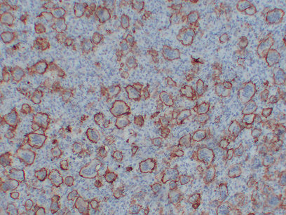 Anti-Integrin beta 3 Mouse Monoclonal Antibody