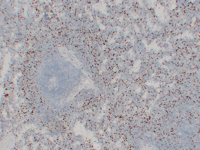 Anti-Integrin beta 3 Mouse Monoclonal Antibody