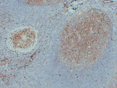 Anti-ICAM1 Mouse Monoclonal Antibody