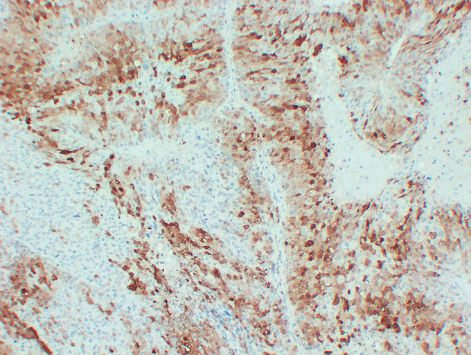 Anti-Liver Arginase Mouse Monoclonal Antibody