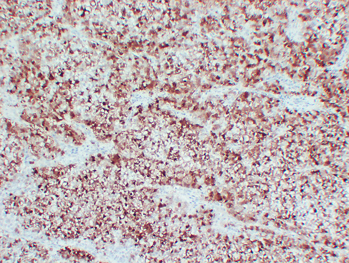 Anti-Liver Arginase Mouse Monoclonal Antibody