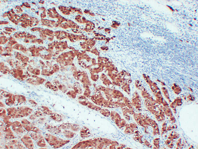 Anti-Liver Arginase Mouse Monoclonal Antibody