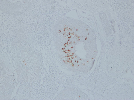 Anti-Mammaglobin A Mouse Monoclonal Antibody