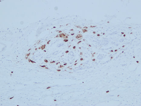 Anti-Mammaglobin A Mouse Monoclonal Antibody