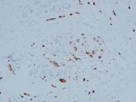 Anti-Mammaglobin A Mouse Monoclonal Antibody