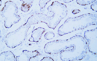 Anti-MAGEC1 Mouse Monoclonal Antibody