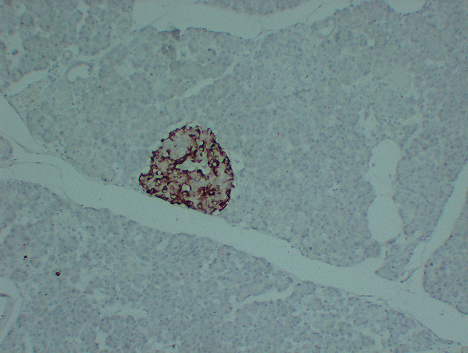 Anti-Metalloproteinase Inhibitor 1 Mouse Monoclonal Antibody