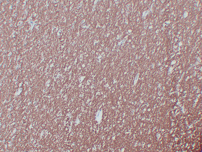 Anti-Myelin Basic Protein Mouse Monoclonal Antibody
