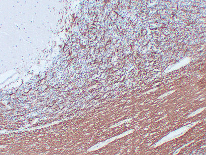 Anti-Myelin Basic Protein Mouse Monoclonal Antibody