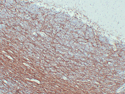 Anti-Myelin Basic Protein Mouse Monoclonal Antibody