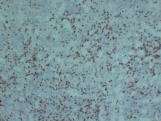 Anti-Myeloperoxidase Mouse Monoclonal Antibody