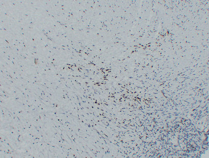 Anti-Myoblast Determination Protein 1 Mouse Monoclonal Antibody