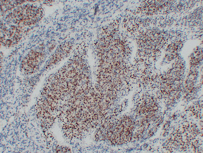 Anti-Myoblast Determination Protein 1 Mouse Monoclonal Antibody