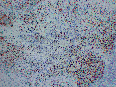 Anti-Myogenin Mouse Monoclonal Antibody