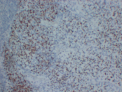 Anti-Myogenin Mouse Monoclonal Antibody