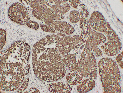 Anti-Mucin 1 Mouse Monoclonal Antibody