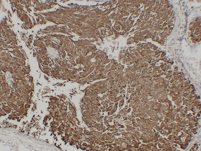 Anti-Mucin 1 Mouse Monoclonal Antibody