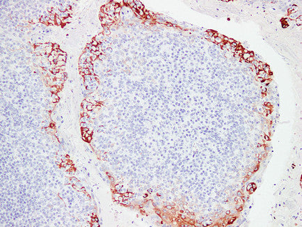 Anti-Mucin 1 Mouse Monoclonal Antibody