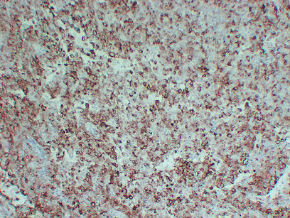 Anti-Melanocyte Protein PMEL Mouse Monoclonal Antibody