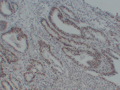 Anti-MSH6 Mouse Monoclonal Antibody