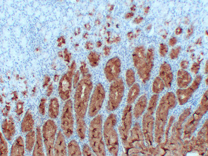 Anti-Mucin 5AC Mouse Monoclonal Antibody