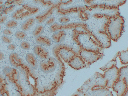 Anti-Mucin 5AC Mouse Monoclonal Antibody