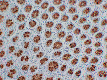 Anti-Mucin 2 Mouse Monoclonal Antibody