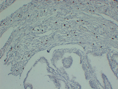 Anti-Mast Cell Tryptase Mouse Monoclonal Antibody