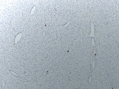 Anti-Mast Cell Tryptase Mouse Monoclonal Antibody